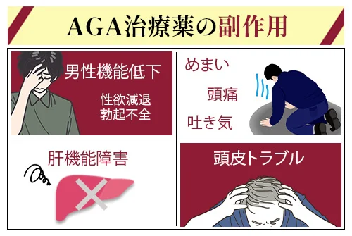 AGA治療薬の副作用