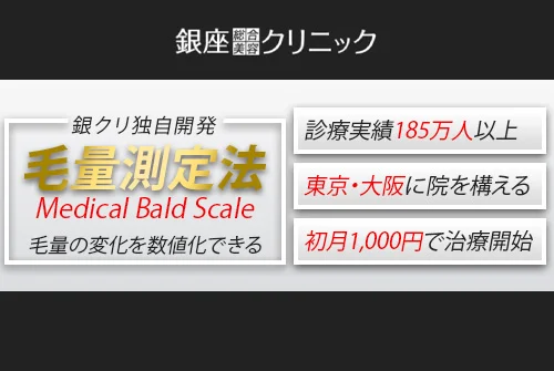 銀座総合美容クリニックは初月1,000円でAGA治療を開始できる